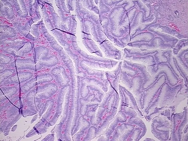 Tissue FFPE Sections, Colon: right - image 1