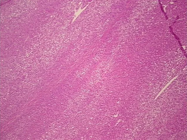 Tissue FFPE Sections, Liver - image 1