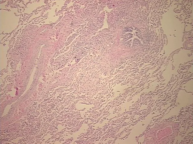 Tissue FFPE Sections, Lung - image 1