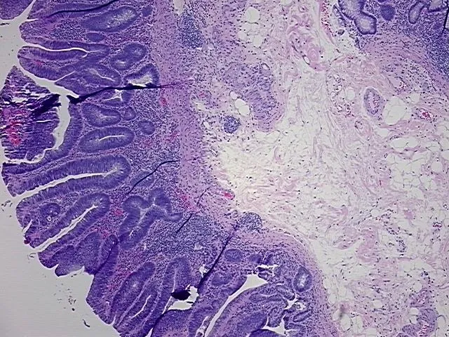 Tissue FFPE Sections, Colon - image 1