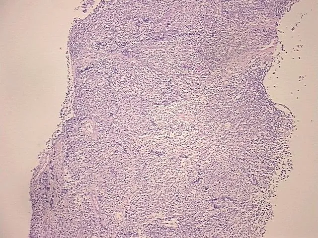 Tissue FFPE Sections, Testis - image 1