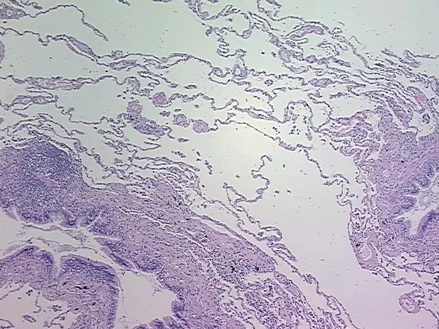 Tissue FFPE Sections, Lung - image 1
