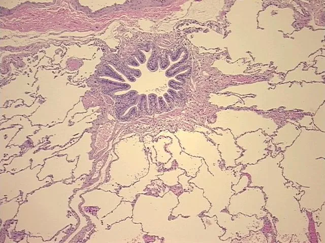 Tissue FFPE Sections, Lung - image 1