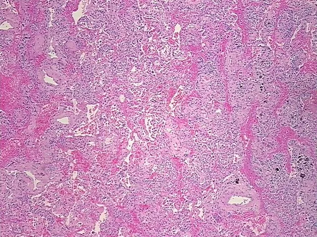 Tissue FFPE Sections, Lung - image 1