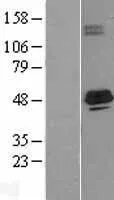ACADS (NM_000017) Human Over-expression Lysate - image 1