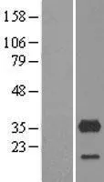 CYB5R3 (NM_000398) Human Over-expression Lysate - image 1