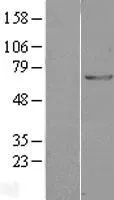 GAD67 (GAD1) (NM_000817) Human Over-expression Lysate - image 1