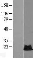 RPS19 (NM_001022) Human Over-expression Lysate - image 1
