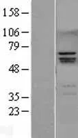 RUNX2 (NM_001024630) Human Over-expression Lysate - image 1