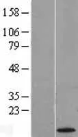 KK LC 1 (CT83) (NM_001017978) Human Over-expression Lysate - image 1