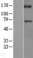 Factor XI (F11) (NM_000128) Human Over-expression Lysate - image 1