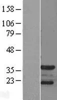 p35 (CDK5R1) (NM_003885) Human Over-expression Lysate - image 1
