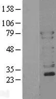 N WASP (WASL) (NM_003941) Human Over-expression Lysate - image 1