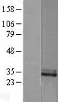CFHL2 (CFHR2) (NM_005666) Human Over-expression Lysate - image 1