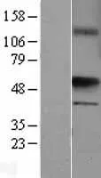 uronyl 2 suLfotransferase (UST) (NM_005715) Human Over-expression Lysate - image 1