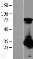 PSME1 (NM_006263) Human Over-expression Lysate - image 1