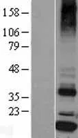 Signal sequence receptor delta (SSR4) (NM_006280) Human Over-expression Lysate - image 1