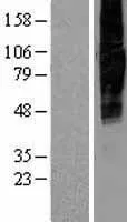 SLC34A2 (NM_006424) Human Over-expression Lysate - image 1