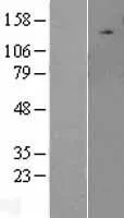 uLK2 (NM_014683) Human Over-expression Lysate - image 1
