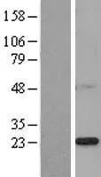 PSF2 (GINS2) (NM_016095) Human Over-expression Lysate - image 1