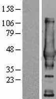 NDRG4 (NM_020465) Human Over-expression Lysate - image 1