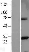 CENPH (NM_022909) Human Over-expression Lysate - image 1