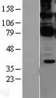 CARD11 (NM_032415) Human Over-expression Lysate - image 1