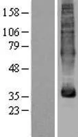MFSD5 (NM_032889) Human Over-expression Lysate - image 1