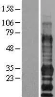 EDARADD (NM_145861) Human Over-expression Lysate - image 1