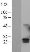 G CSF (CSF3) (NM_172220) Human Over-expression Lysate - image 1