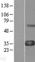 CCN4 (NM_080838) Human Over-expression Lysate - image 1