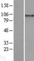 FOXM1 (NM_202003) Human Over-expression Lysate - image 1