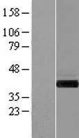 GIPC (GIPC1) (NM_202470) Human Over-expression Lysate - image 1