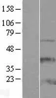 ZCCHC13 (NM_203303) Human Over-expression Lysate - image 1