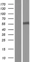 SLC22A12 (NM_144585) Human Over-expression Lysate - image 1