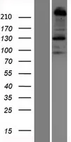 Plexin B1 (PLXNB1) (NM_002673) Human Over-expression Lysate - image 1