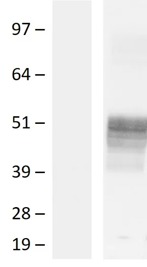 TACD2 (TACSTD2) (NM_002353) Human Over-expression Lysate - image 1