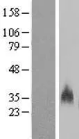 GYPB (NM_002100) Human Over-expression Lysate - image 1