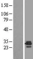ETFB (NM_001985) Human Over-expression Lysate - image 1