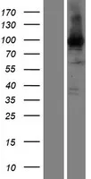 EEF2 (NM_001961) Human Over-expression Lysate - image 1