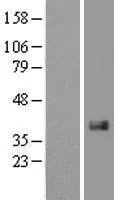 CCN2 (NM_001901) Human Over-expression Lysate - image 1