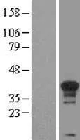 Cyclin H (CCNH) (NM_001239) Human Over-expression Lysate - image 1