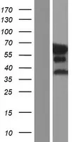 Epsin 2 (EPN2) (NM_001102664) Human Over-expression Lysate - image 1