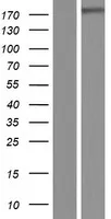 LTBP4 (NM_001042544) Human Over-expression Lysate - image 1