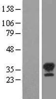 STK16 (NM_001008910) Human Over-expression Lysate - image 1