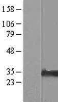 NIPA2 (NM_001008860) Human Over-expression Lysate - image 1