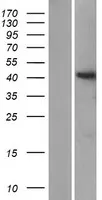 ST8SIA6 (NM_001004470) Human Over-expression Lysate - image 1