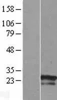 ZNF740 (NM_001004304) Human Over-expression Lysate - image 1