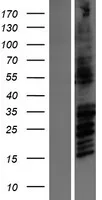 NMDAR2B (GRIN2B) (NM_000834) Human Over-expression Lysate - image 1