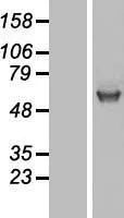 UGT (UGT1A1) (NM_000463) Human Over-expression Lysate - image 1